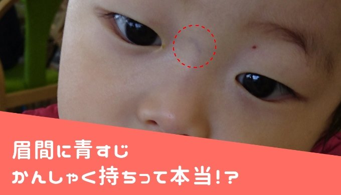 赤ちゃんの眉間に青い筋が見えると 癇癪もち 疳の虫 になるって本当 ママグラフィティ